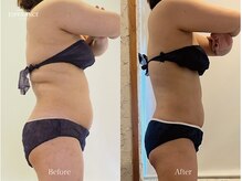 エステティックサロン エスぺランス(ESPERANCE)/体質を変えて1年で-10kg!