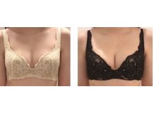 エスビューティー 三軒茶屋(S beauty)/バストアップ・痩身・池尻大橋