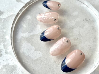ブレスネイル(brace Nail)の写真