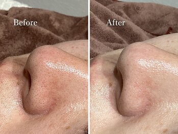 エリー(Ellie)/SNSの過剰広告に注意を！