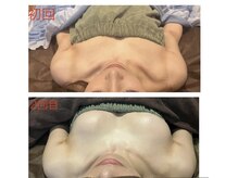 フェイシャル・バストケア・ネイル・まつ毛パーマ一度に解決♪