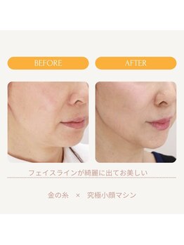 ミーティア(Meteor)/