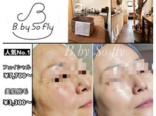 ビードット バイ ソーフライ(B.by So fly)