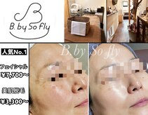 ビードット バイ ソーフライ(B.by So fly)