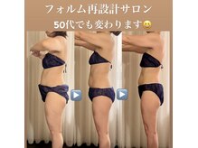 サロン ド プリヴェ(Salon de PRIVE)の雰囲気(フォルム再設計/首肩こり/背中/二の腕/お腹腰回り/太もも,お尻)