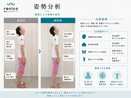 レニコ 三宮店(renico)の写真