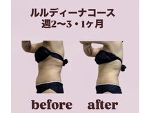 ヨサパーク リアン(YOSA PARK Lien)/モニター様before→after/痩身