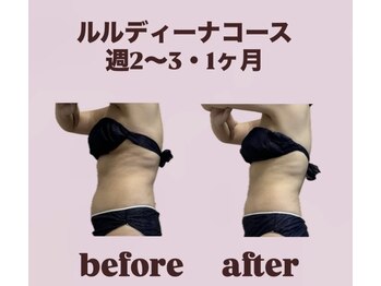 ヨサパーク リアン(YOSA PARK Lien)/モニター様before→after/痩身