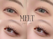 メルト(MELT)
