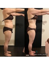 リンネ(Linne)/ビフォーアフター