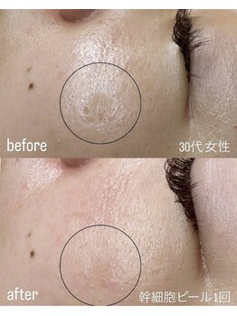 フロル(FLOR)/FLOR 【根本改善専門店】