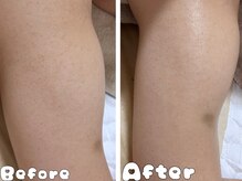 グラシア 倉敷店(Gracia)/お客様の施術事例