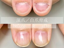 ル リアン 北浦和(le lien)/深爪育成(5ヶ月／6回)