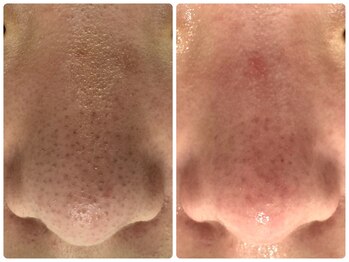 サイセイ(SAISEI)/