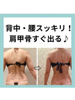 トータルビューティージュネス(JEUNESSE)の写真/年齢サインと諦めていた贅肉にアプローチ!加齢で厚くなった背中・二の腕をスッキリ♪