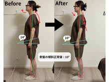 ベルヴェラ(Belvela)の雰囲気（施術の一例。姿勢を確認し、身体の状態に合わせて施術します。）