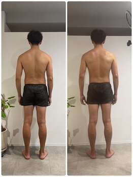 エイジングケアサロン 青山 本店/【メンズ】ビフォア・アフター