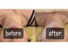 クレール 小山店(CLAIR)/【首へ美肌フォト】