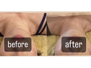 クレール 小山店(CLAIR)/【首へ美肌フォト】