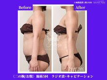フェレザ 新潟(Felleza)/採寸/採寸表も無料作成で楽♪