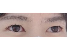 アイラッシュ エヌ(eyelash eNu)/トリートメントまつ毛パーマ