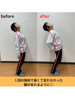 アオ整体院/60代女性肩こり・腰痛 B→A