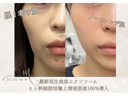 サロン ド エム(salon de m)の写真
