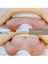 サロン ヴィプラス(SALON Vi+)/初回バストケアのBeforeAfter