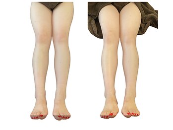 ベンザイ 新潟店(BENZAI)/脚が軽い！伝わらないB/A