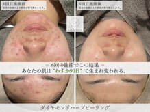 エルブイ 江坂(LV)