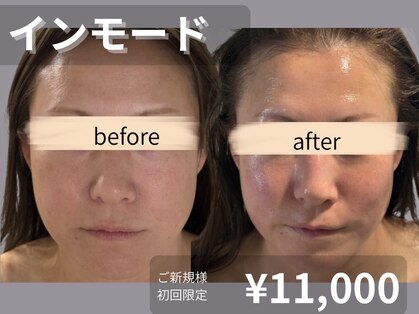 リズ(rE:S)の写真