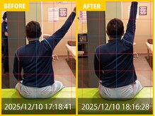 整体院 元 光の森店/肩の動作痛と可動域制限