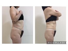 マッチ(much)/上半身集中ケア