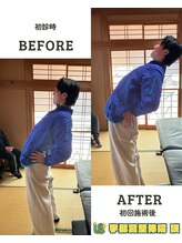 宇都宮整体院 咲/ビフォーアフター