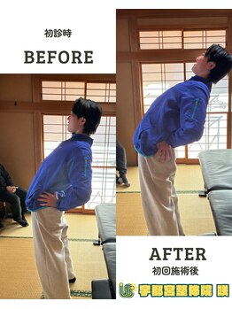 宇都宮整体院 咲/ビフォーアフター