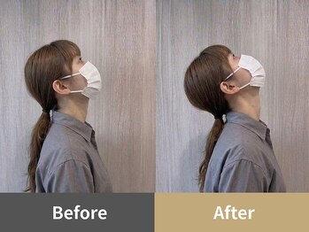 整体クオーレ 奈良新大宮店(Cuore)/Before After