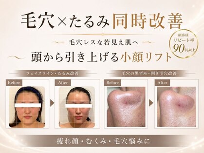 ラナン パラフューズ(Ranun's PARAFUSE.)の写真