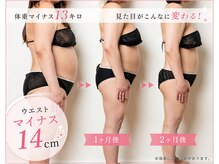 ヨサパーク アカーシャ(YOSA PARK AKASHA)/2ヶ月でここまで変化