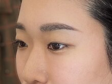 ビューティーガーデン イース/AFTER