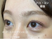 ミベレ 八王子(Mebere)/ハリ・コシアップでパキッと