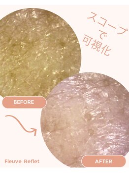 フルーヴ ルフレ(Fleuve Reflet)/電子カルテに記録し保管！