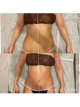 エクラ(eclat)/セルクラ