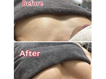 アーチ(AR-CH.)の雰囲気（バストケア3回目！ふっくら谷間まで♪下着をつけると更に綺麗に）