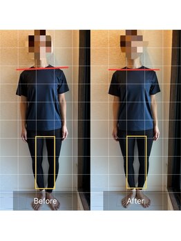 ライトワーク 西新宿店/O脚矯正・体の歪み矯正