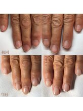 ティヤム(TIAM)/自爪育成ネイル☆