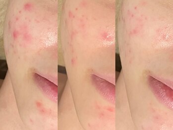 ゾーンビューティーハウス 柏店(ZONE BEAUTY HOUSE)/☆サロンケア×ホームケア☆