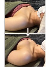 スマイルクルー(SmileClue)/ビフォーアフター症例