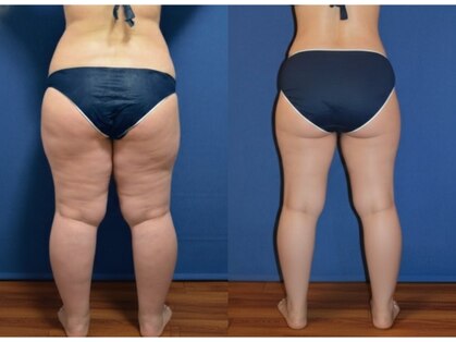 アンシャンテ姫路の写真