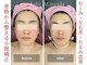 エステティック ベルミランダの写真