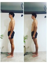 エイジングケアサロン 青山 本店/【メンズ】ビフォア・アフター